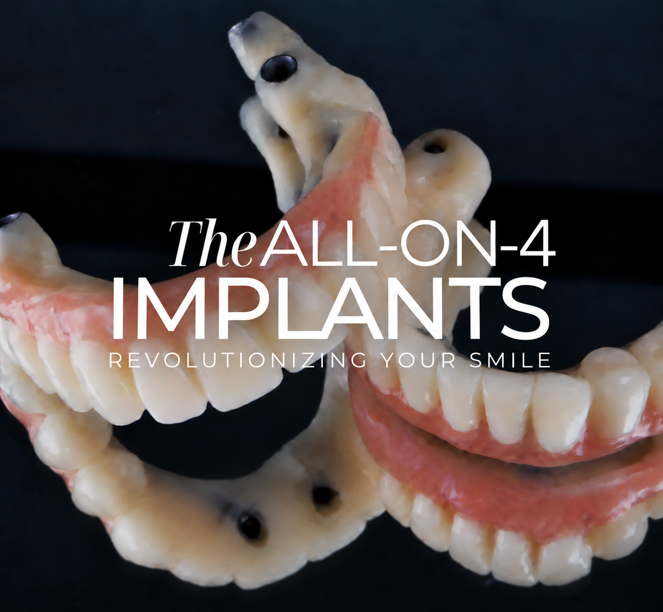 固定式の人工歯と、中央に配置したThe ALL-ON-4 IMPLANTSの文字