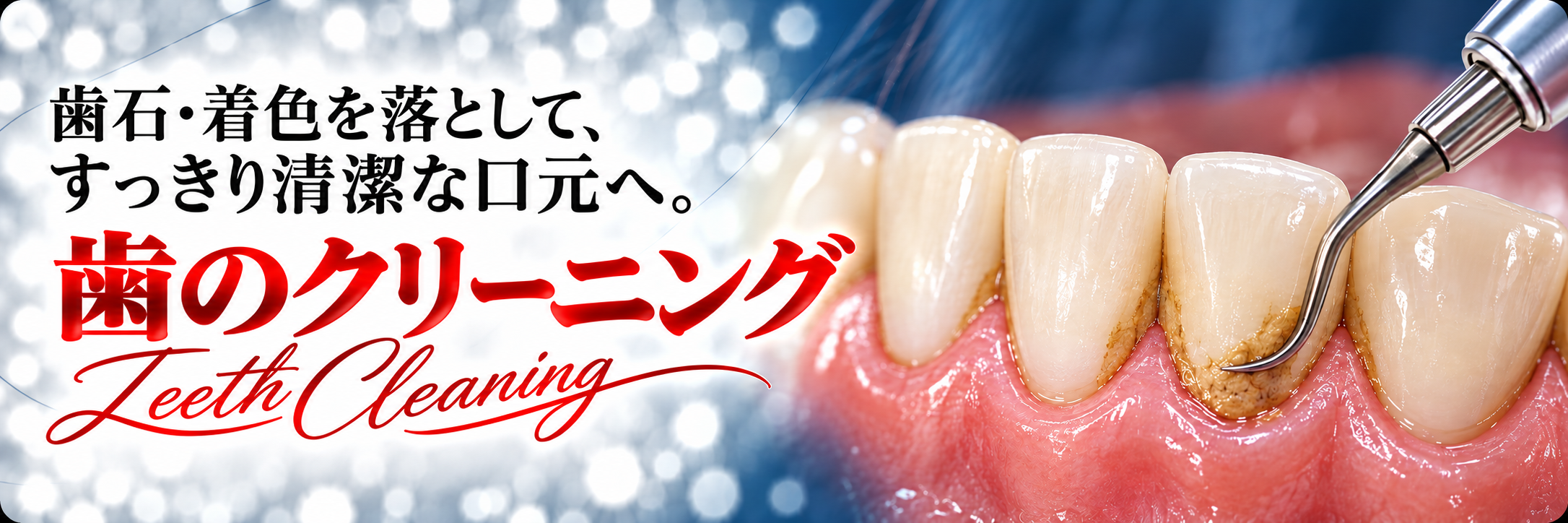 歯石・着色を落として、すっきり清潔な口元へ。歯のクリーニング｜Teeth Cleaning
