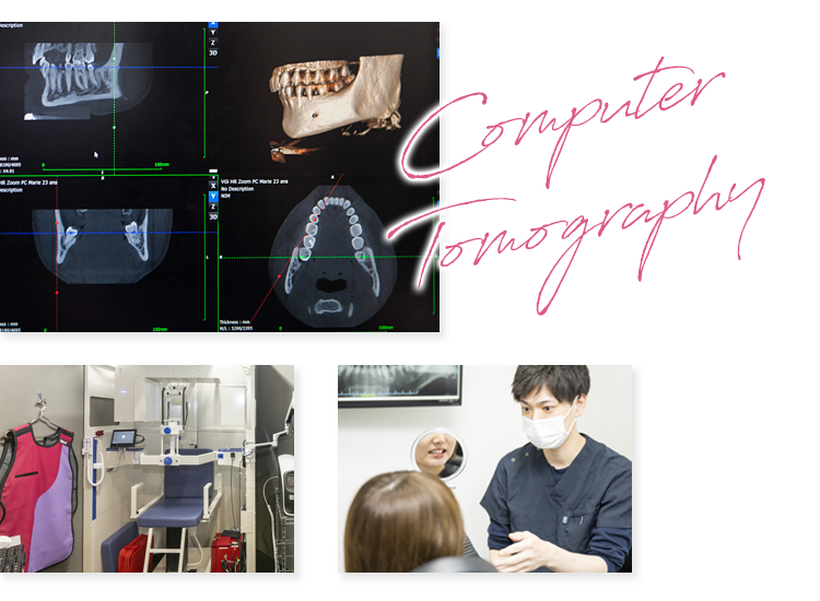 秋葉原院の歯科用CT