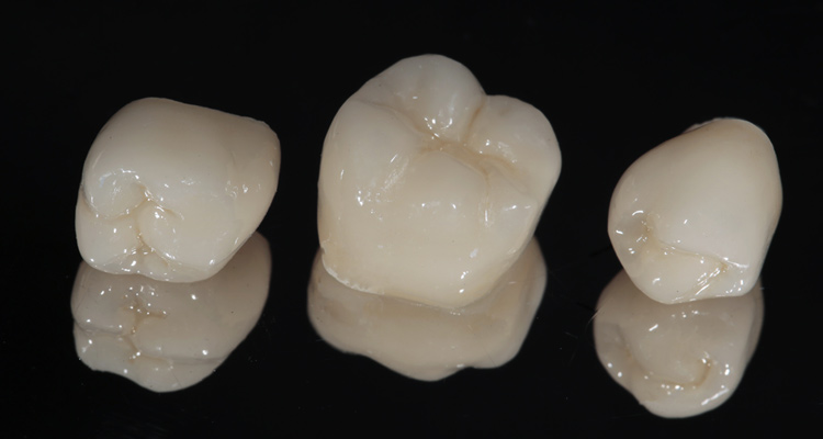 歯科&矯正歯科オーラルデザインクリニック秋葉原のセラミック治療なら白く美しい歯を再現できます