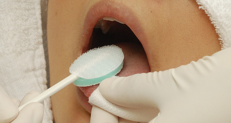 歯科&矯正歯科オーラルデザインクリニック秋葉原のクリーニングで舌の汚れの除去