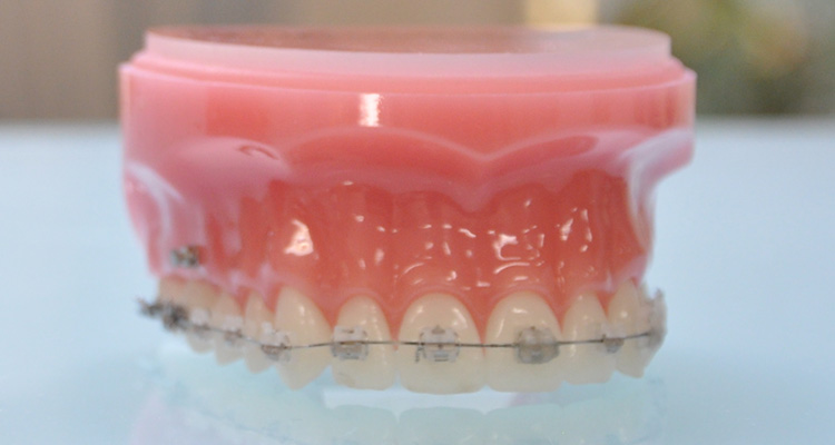 歯科＆矯正歯科オーラルデザインクリニック秋葉原の表側矯正
