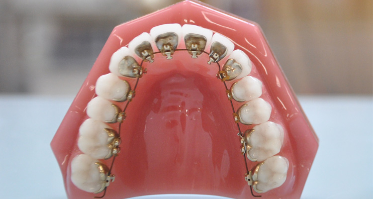 歯科＆矯正歯科オーラルデザインクリニック秋葉原の裏側矯正