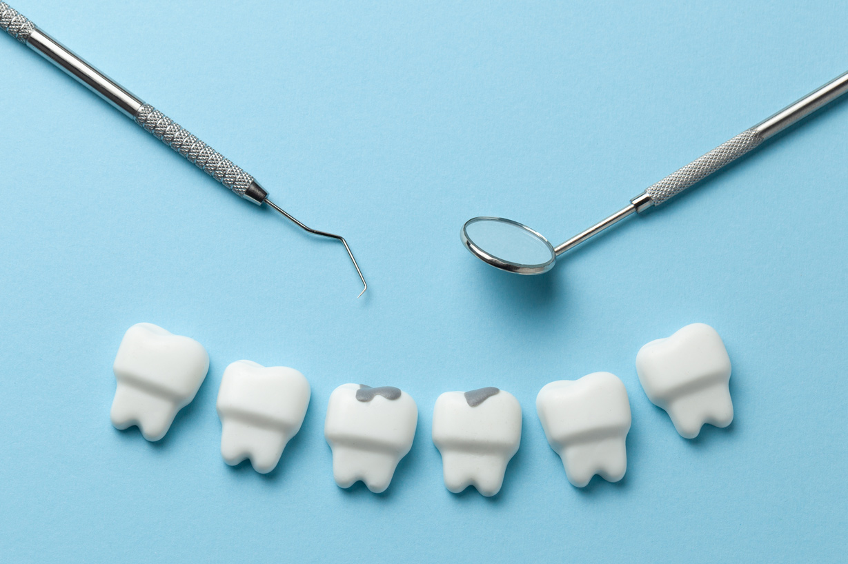 歯科＆矯正歯科オーラルデザインクリニック秋葉が伝える虫歯のでき方
