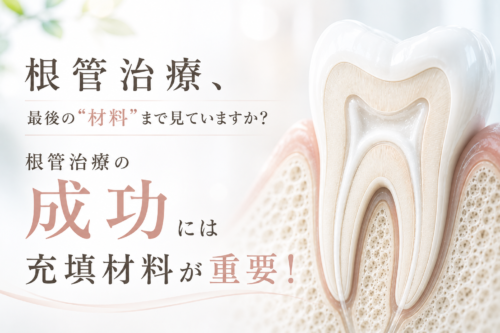 根管治療の成功には充填材料が重要！